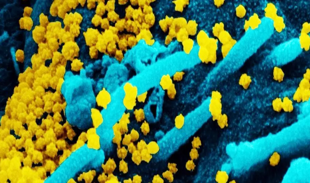 Los efectos del SARS-CoV-2 varían de acuerdo al organismo de cada persona | Foto: Instituto Nacional de Alergias y Enfermedades Infecciosas