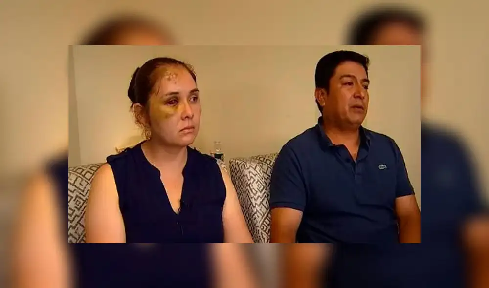 Madre recibió brutal golpiza tras denunciar los ataques racistas que recibía hijo en el colegio. Foto: NBC New York. Madre recibió brutal golpiza tras denunciar los ataques racistas que recibía hijo en el colegio. Foto: NBC New York.