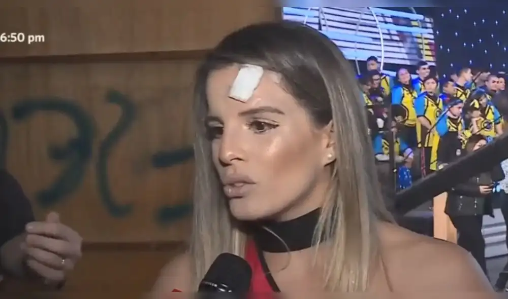 Alejandra Baigorria tiene cuatro puntos en el rostro tras sufrir fuerte lesión en EEG Alejandra Baigorria tiene cuatro puntos en el rostro tras sufrir fuerte lesión en EEG