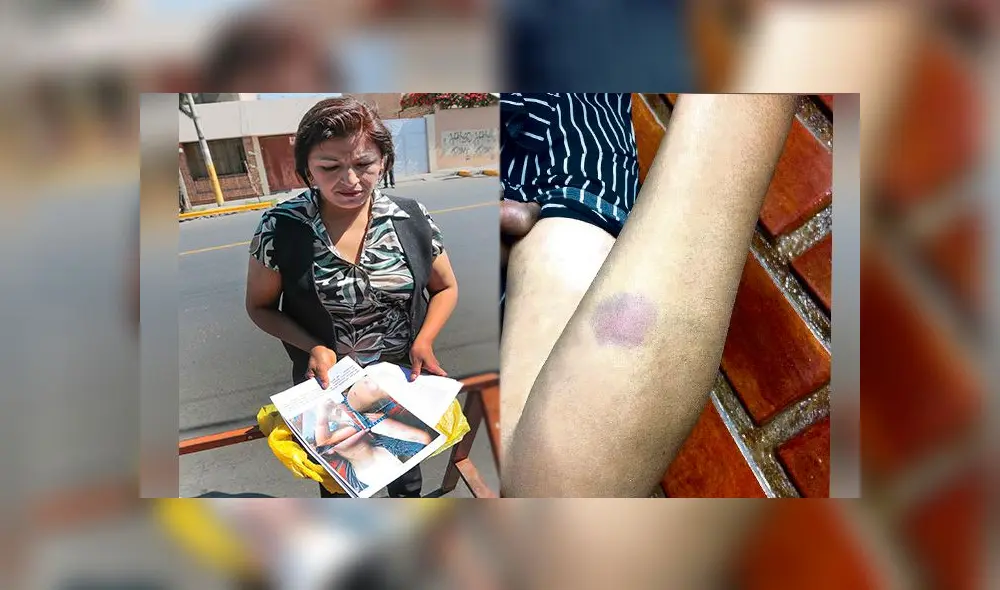 Esposa denunció maltrato físico por parte de la autoridad Esposa denunció maltrato físico por parte de la autoridad