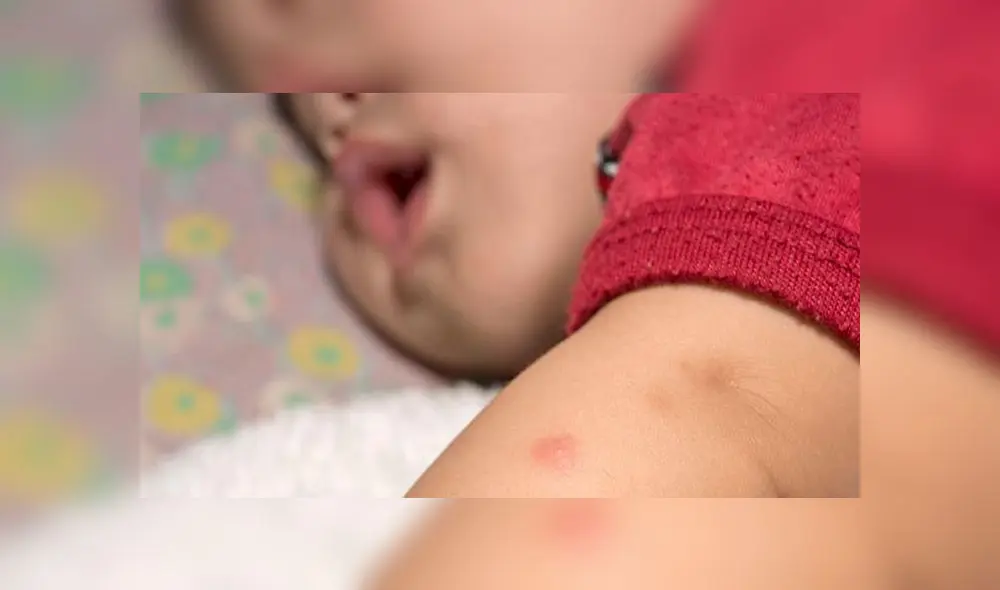 Familia muere tras ser picada por garrapatas y adquirir extraña enfermedad