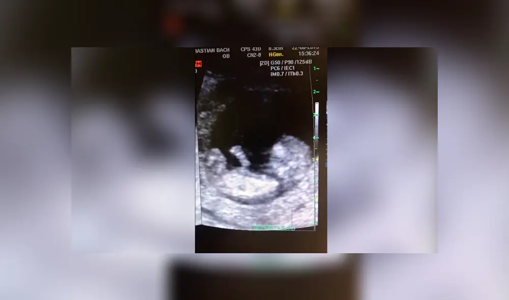 Facebook viral: bebé de 12 semanas juega a la ‘resbaladilla’ en el vientre de su madre y todo queda registrado Facebook viral: bebé de 12 semanas juega a la ‘resbaladilla’ en el vientre de su madre y todo queda registrado