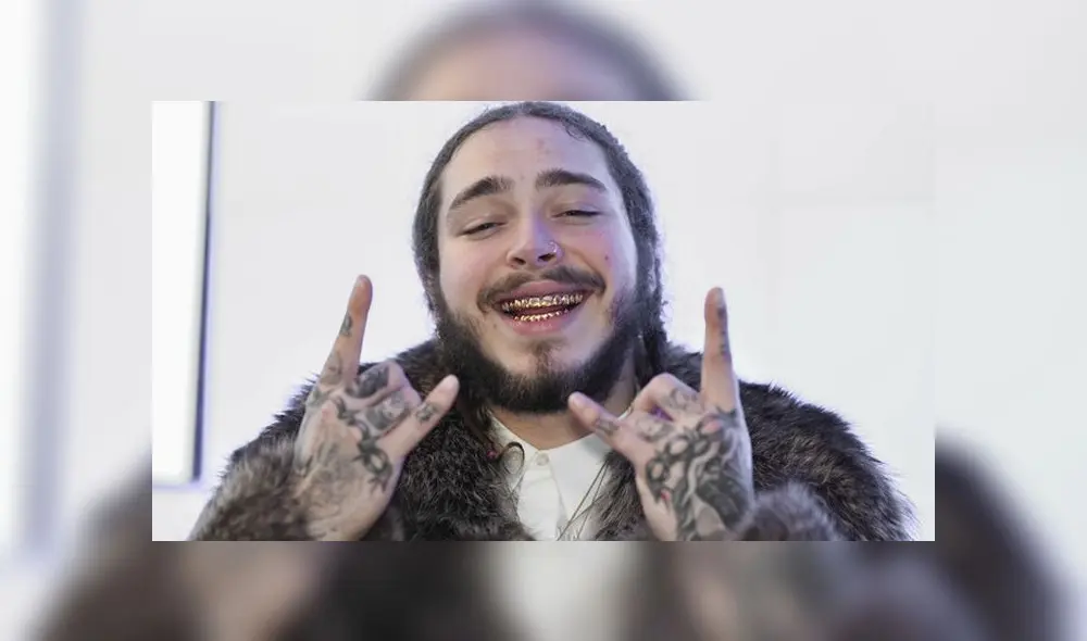A través de las redes sociales, los seguidores del rapero estadounidense Post Malone; mostraron su preocupación por la salud del artista. A través de las redes sociales, los seguidores del rapero estadounidense Post Malone; mostraron su preocupación por la salud del artista.