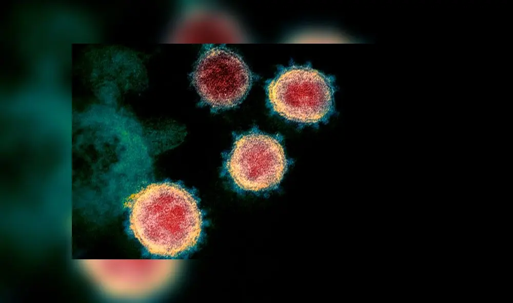 Imagen microscópica del coronavirus causante del COVID-19 en un paciente de EE. UU. Crédito: NIAID RML.