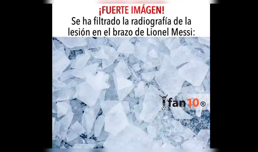 Facebook: lesión de Lionel Messi desató curiosos memes en las redes [FOTOS]