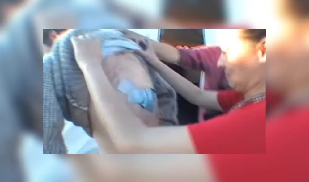 YouTube viral: joven va al médico por roncha en su espalda y le hacen espeluznante hallazgo [VIDEO]