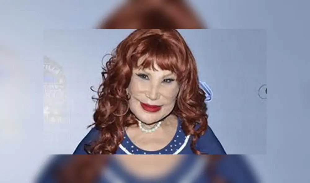 Lyn May muestra su nuevo rostro tras someterse a una cirugía estética [VIDEO]
