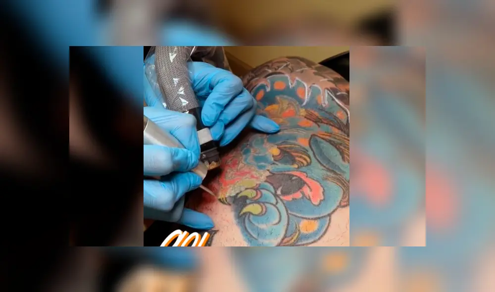 Facebook viral: joven intenta quitarse tatuaje del brazo, sin imaginar el terrible resultado que tendría