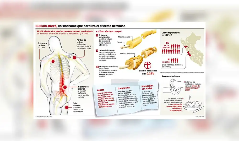 Guillaen Barré: síndrome ataca el sistema inmunológico y causa parálisis Guillaen Barré: síndrome ataca el sistema inmunológico y causa parálisis