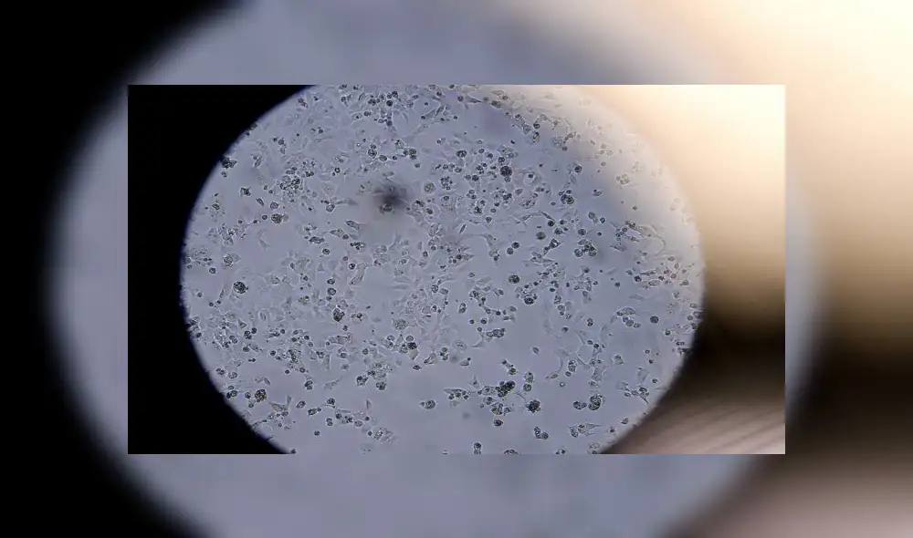 Cells containing the novel coronavirus SARS-CoV-2 are seen through a microscope at the Stabilitech laboratory in Burgess Hill south east England, on May 15, 2020 where scientists are trying to develop an oral vaccine for the COVID-19 illness. - The scientists at Stabilitech are one of the teams attempting to develop a vaccine for COVID-19. Ingested in a capsule into the gut, Stabilitech's potential oral vaccine aims to prompt an immune response in mucosal cells in the respiratory system and elsewhere in the body. The firm believes that will be more effective in tackling respiratory illnesses like coronavirus. The British government is touting the country as a global leader in the big-money investment race to find a vaccine for COVID-19. (Photo by BEN STANSALL / AFP) / TO GO WITH AFP STORY BY JOE JACKSON Cells containing the novel coronavirus SARS-CoV-2 are seen through a microscope at the Stabilitech laboratory in Burgess Hill south east England, on May 15, 2020 where scientists are trying to develop an oral vaccine for the COVID-19 illness. - The scientists at Stabilitech are one of the teams attempting to develop a vaccine for COVID-19. Ingested in a capsule into the gut, Stabilitech's potential oral vaccine aims to prompt an immune response in mucosal cells in the respiratory system and elsewhere in the body. The firm believes that will be more effective in tackling respiratory illnesses like coronavirus. The British government is touting the country as a global leader in the big-money investment race to find a vaccine for COVID-19. (Photo by BEN STANSALL / AFP) / TO GO WITH AFP STORY BY JOE JACKSON