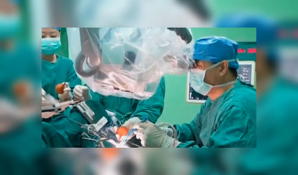 Wang Lei fue tratado de un tumor maligno, sin imaginar que el médico lo descartaría y encontraría un parásito de 12 cm.