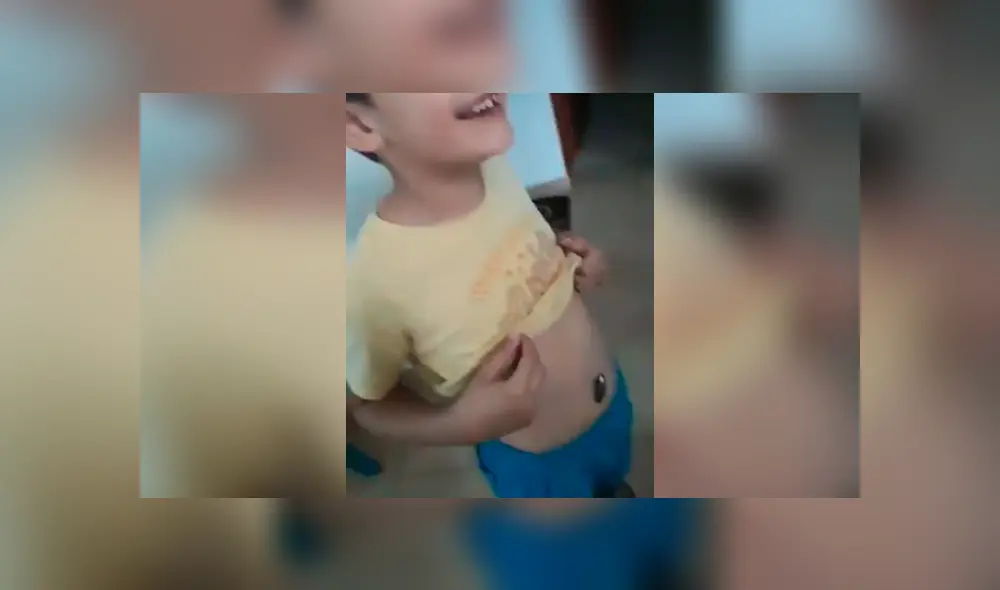 Facebook viral: niño se traga imán y sus padres hacen algo increíble para intentar ayudarlo