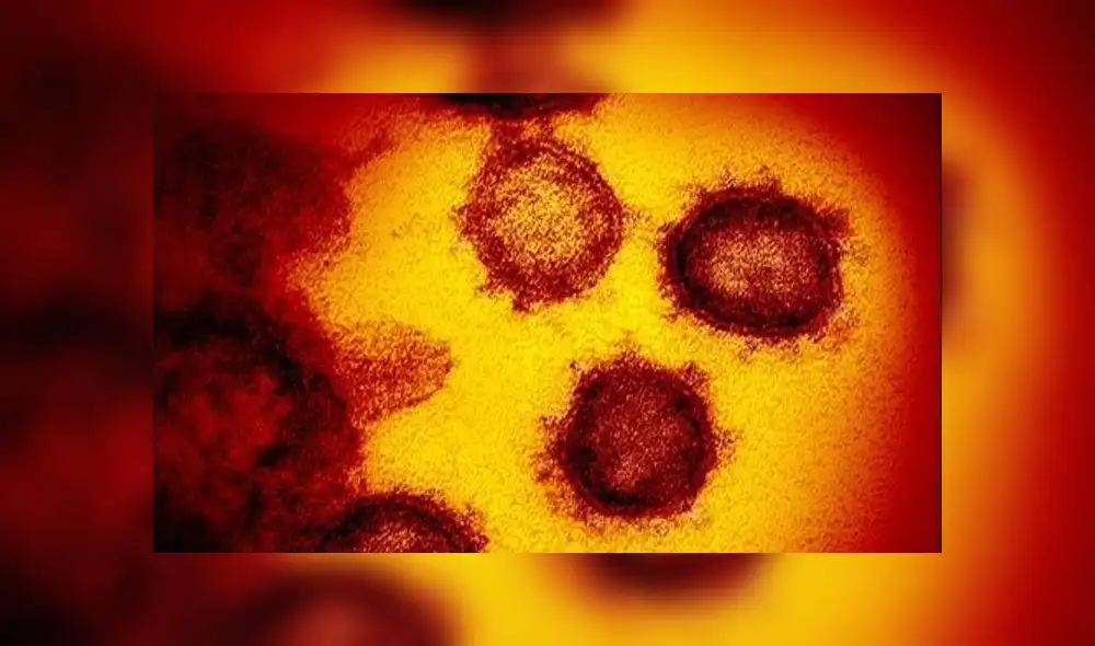 Imagen microscópica del coronavirus causante del COVID-19. Crédito: NIAID (Estados Unidos).