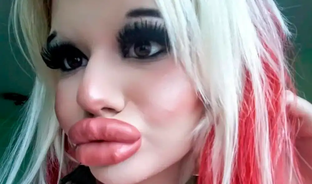 Adolescente quiso ser como ‘Barbie’, pero terminó pareciéndose a una muñeca inflable