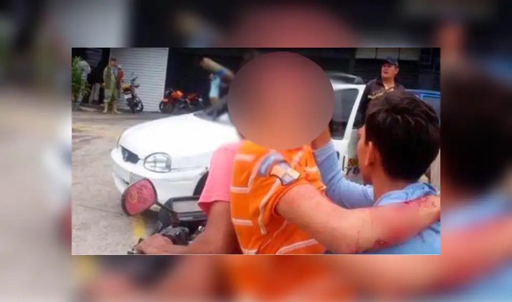 Venezuela: estudiante queda ciego tras recibir impacto de perdigón en el rostro por parte de policía  [ FOTOS]