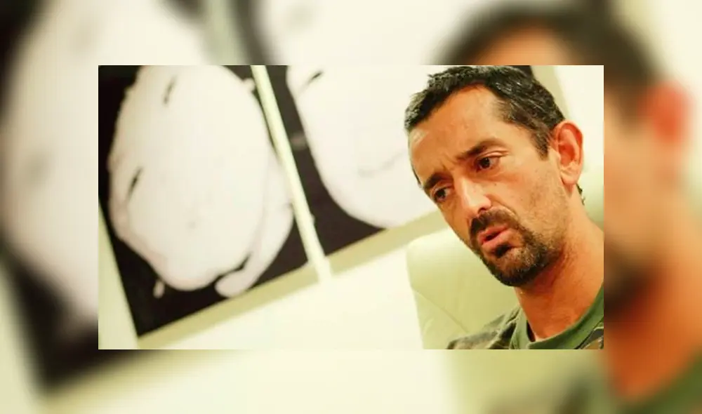 El cirujano español tuvo que intervenir a un niño africano y quitarle un tumor que era más grande que su cabeza. El cirujano español tuvo que intervenir a un niño africano y quitarle un tumor que era más grande que su cabeza.