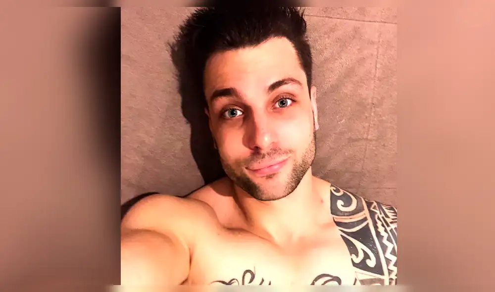 Nicola Porcella se opera el rostro para regresar a "Esto es guerra"