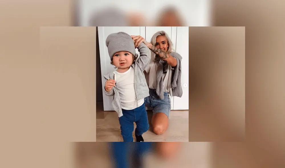 Bebé nace con extraña enfermedad en la piel y su madre influencer lo presume con orgullo [FOTOS]