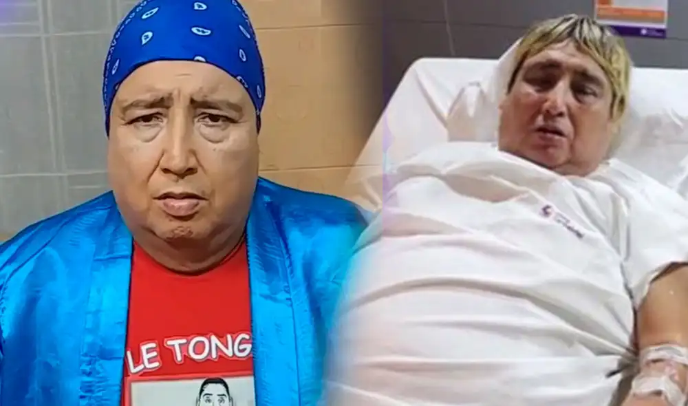 La salud de Tongo se complicas tras extirparle tumor. Foto: difusión