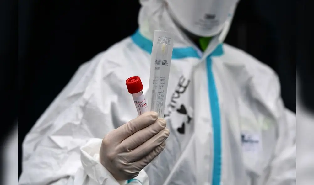 A hospital employee wearing protection mask and gear shows a swab, a cotton wab for taking mouth specimen, used at a temporary emergency structure set up outside the accident and emergency department, where any new arrivals presenting suspect new coronavirus symptoms will be tested, at the Brescia hospital, Lombardy, on March 13, 2020. (Photo by Miguel MEDINA / AFP) A hospital employee wearing protection mask and gear shows a swab, a cotton wab for taking mouth specimen, used at a temporary emergency structure set up outside the accident and emergency department, where any new arrivals presenting suspect new coronavirus symptoms will be tested, at the Brescia hospital, Lombardy, on March 13, 2020. (Photo by Miguel MEDINA / AFP)