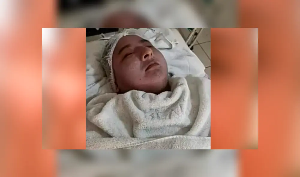 Facebook viral: 'Tapir 590' se somete a radical tratamiento de belleza y sorprende a sus fans [VIDEO] 