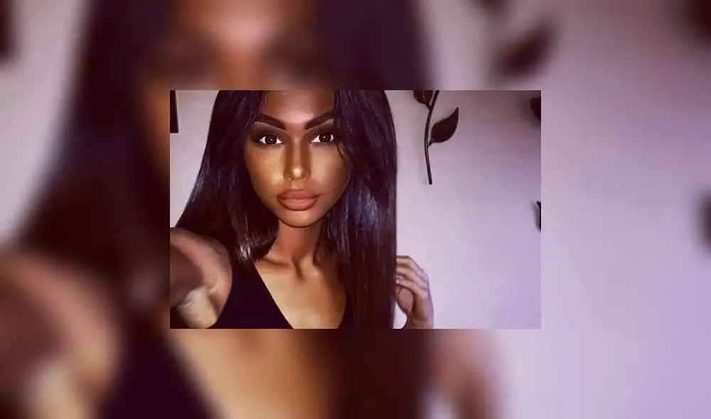 Joven se inyecta fármaco tres veces por semana para oscurecer su piel  [FOTOS]