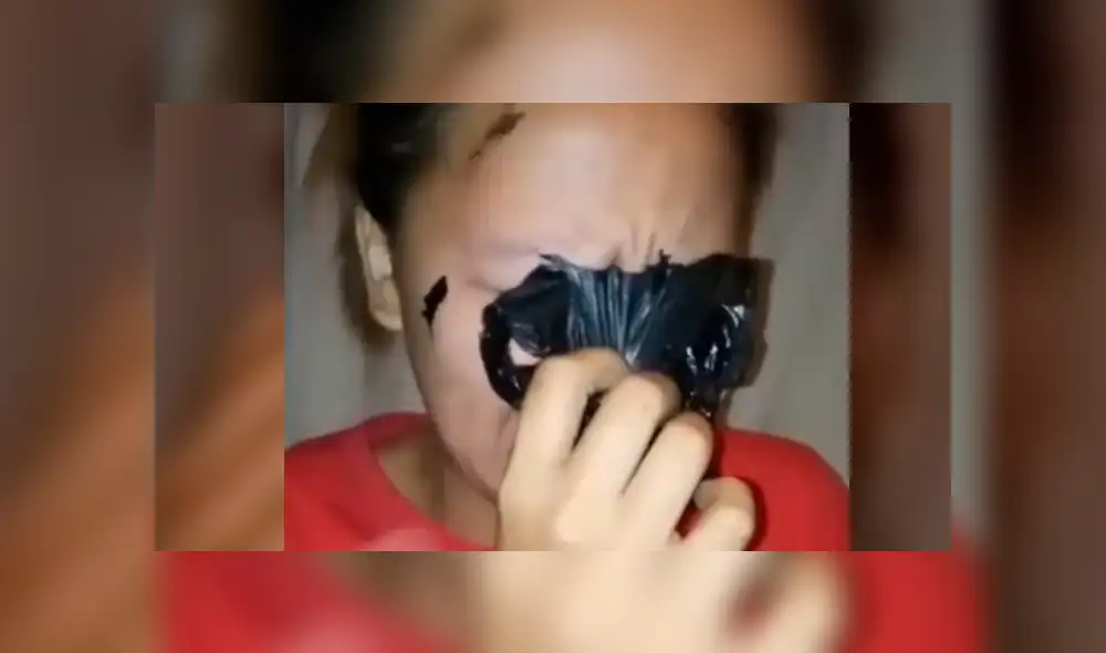 Facebook: muchacha asiática deseaba lucir como estrella K-Pop y se termina 'desfigurando' el rostro