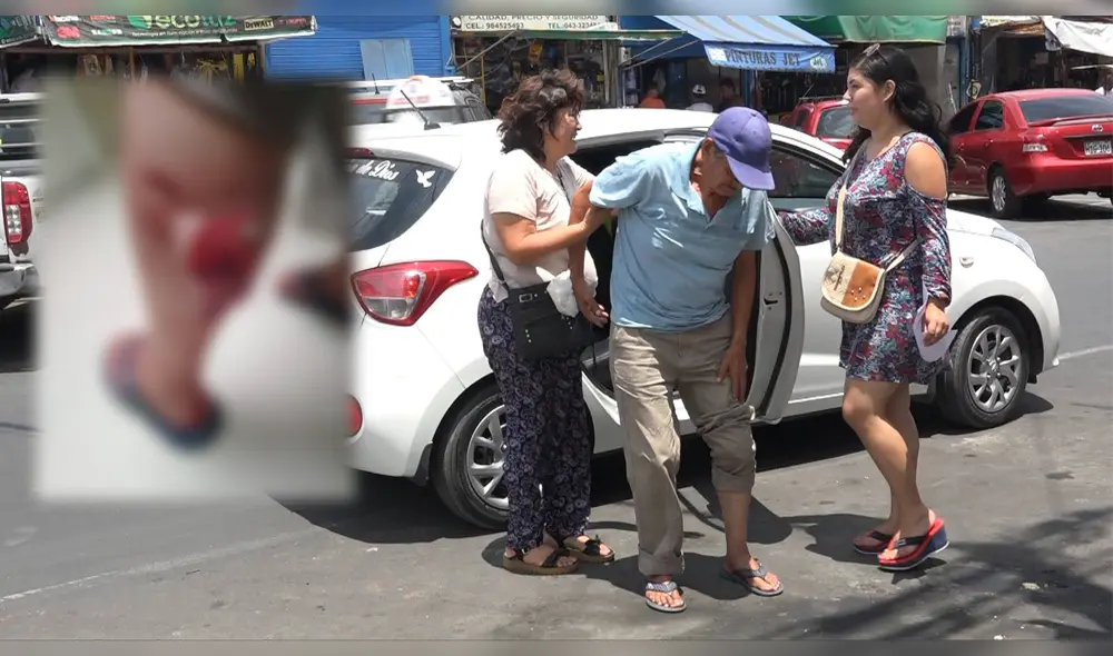 Anciano es nueva víctima de ataque de perro pitbull en Chimbote