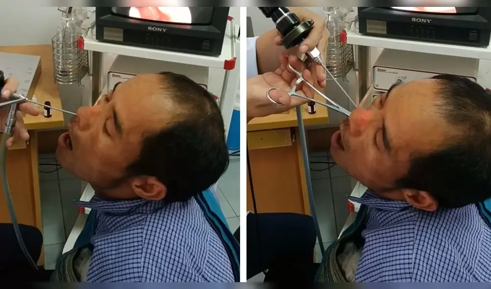 Facebook viral: acude al médico para que revisen su nariz y le descubren lo más aterrador [VIDEO]