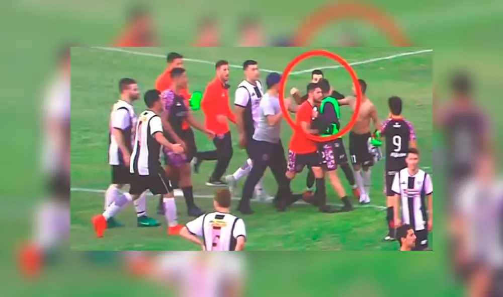 Arquero recibió brutal golpe en la cara y terminó con un edema en la retina [VIDEO]