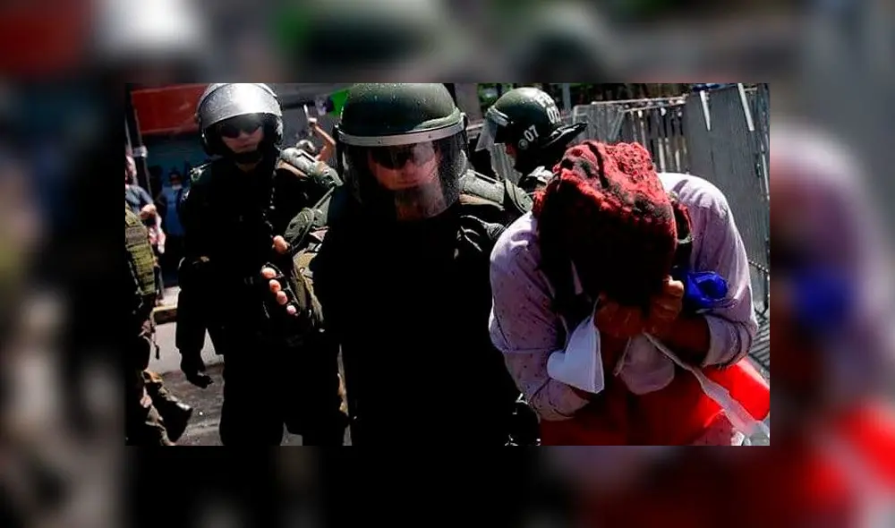 La Sochiof reportó que 24 personas perdieron la vista de un ojo, a raíz de los enfrentamientos con los oficiales. Foto: Difusión La Sochiof reportó que 24 personas perdieron la vista de un ojo, a raíz de los enfrentamientos con los oficiales. Foto: Difusión