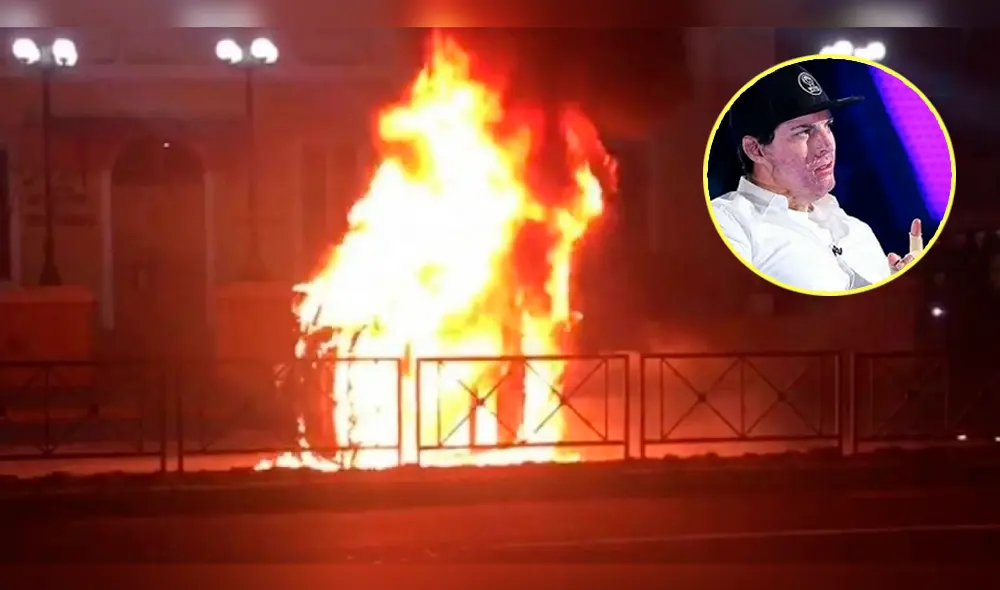 Exchico reality mostró cómo quedó su cuerpo tras sobrevivir al 90% de quemaduras en accidente