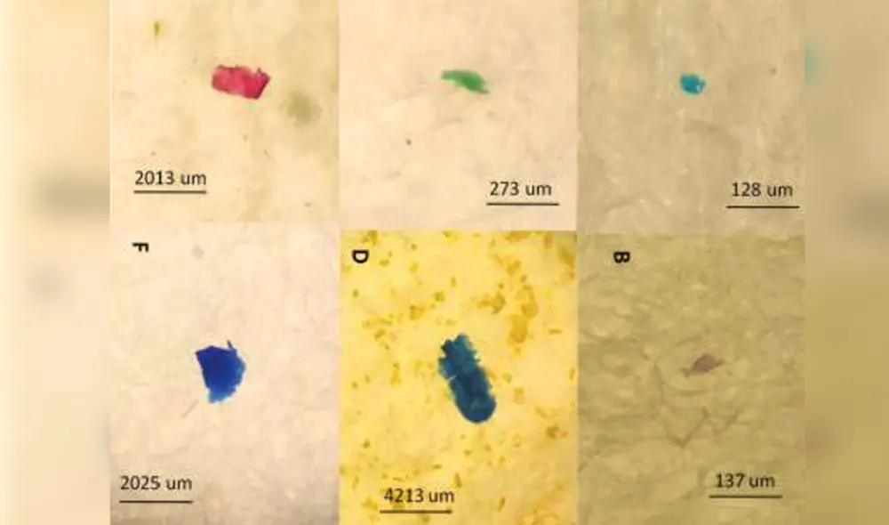 Microplásticos, clasificados según el color, hallados en los peces. Fotos: José Iannacone