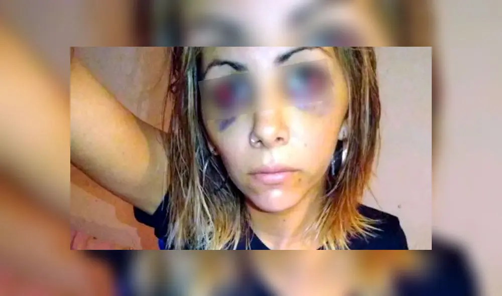 “Agradéceme que no te pegué un tiro”, la cobarde frase de un sujeto tras agredir a su expareja [VIDEO]