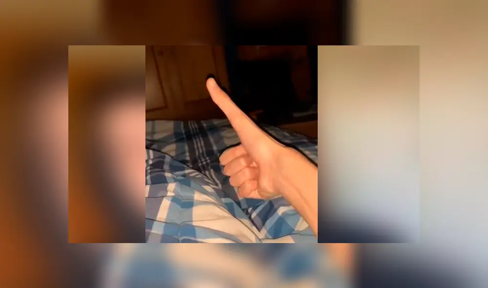 Su extraña condición ha causado sensación en Facebook, luego de difundir su peculiar malformación a través de unos videos