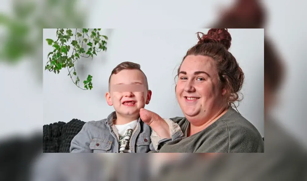 Su madre decidió registrar toda la evolución de su hijo, que compartió en redes sociales. (Foto: The Sun) Su madre decidió registrar toda la evolución de su hijo, que compartió en redes sociales. (Foto: The Sun)