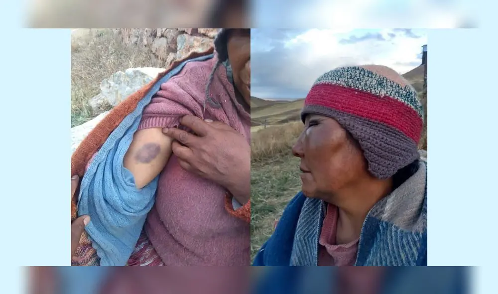 Puno. Humilde mujer fue cruelmente golpeada.
