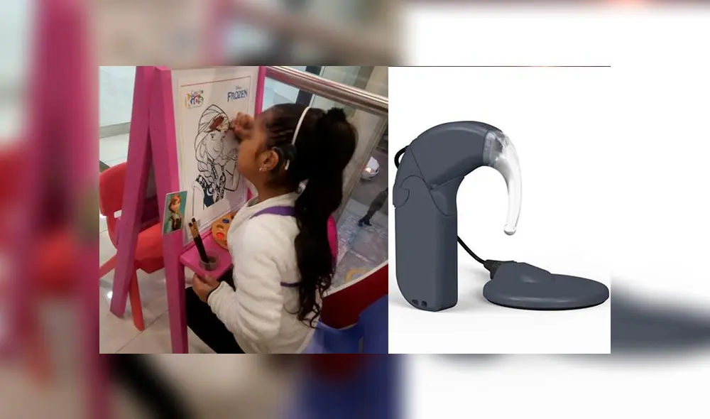 El implante personalizado no permite que otra persona pueda utilizarlo. El implante personalizado no permite que otra persona pueda utilizarlo.