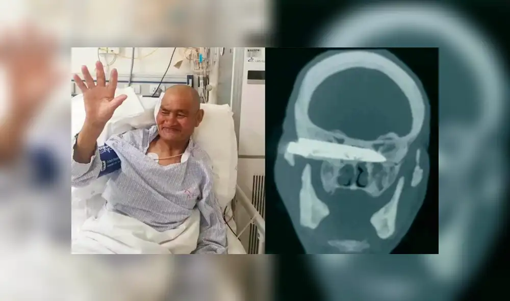 Duorijie sobrevivió al violento asalto, pero acabó con un cuchillo clavado en la cabeza. (Foto: Difusión)