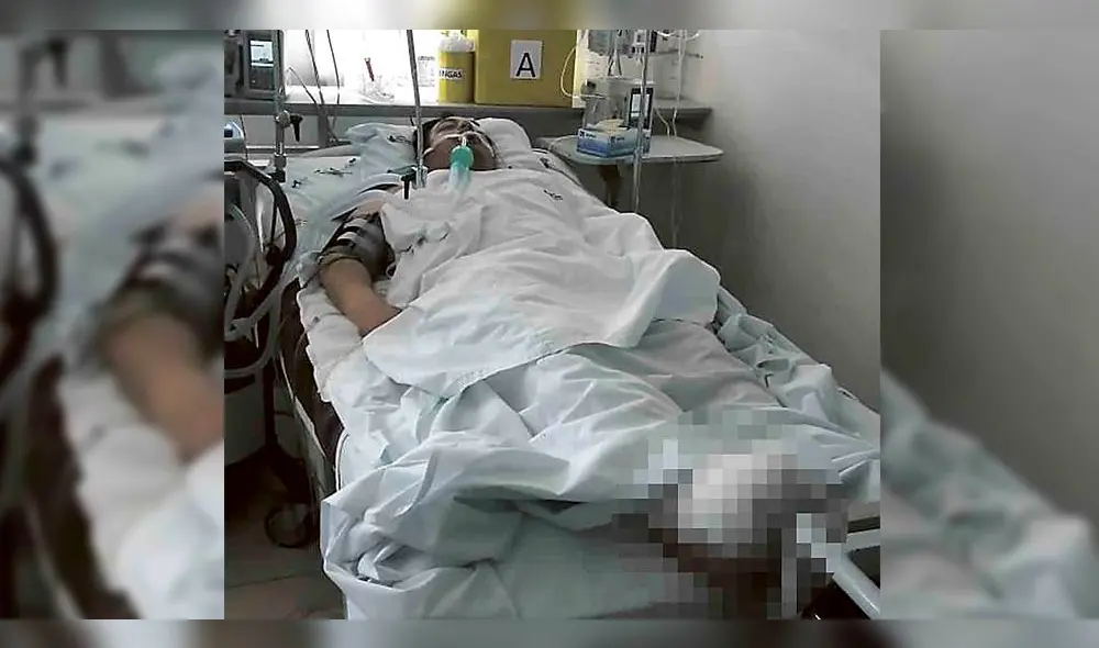 Obrero fue atropellado por apurar la inauguración de la Variante de Uchumayo Obrero fue atropellado por apurar la inauguración de la Variante de Uchumayo