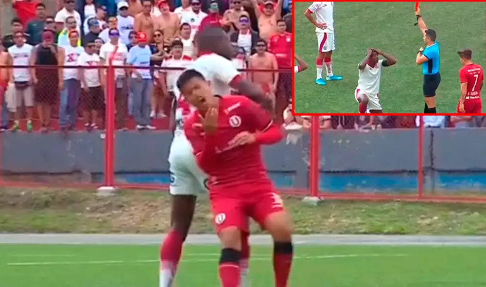 Osorio sufrió un codazo en el rostro durante el partido entre Universitario y UTC. | Foto: Gol Perú Osorio sufrió un codazo en el rostro durante el partido entre Universitario y UTC. | Foto: Gol Perú