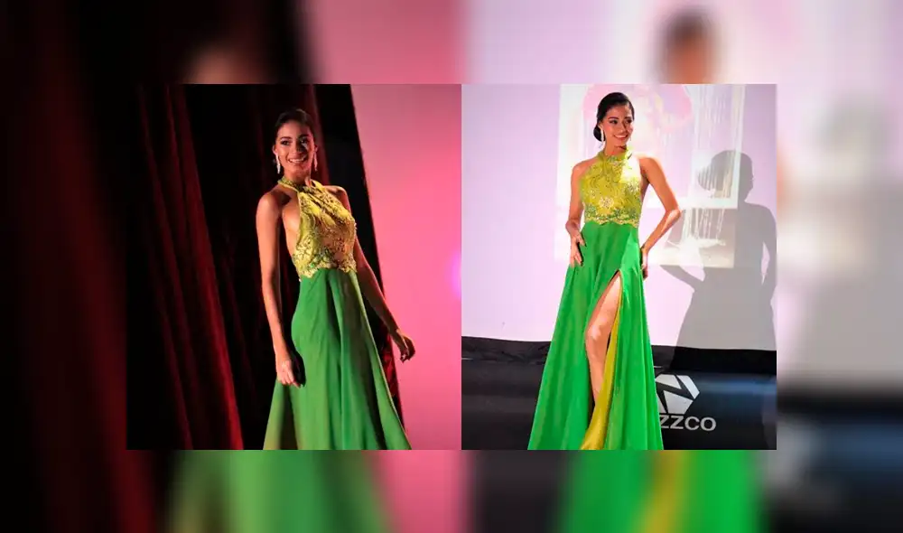 Candidata panameña asegura que fue expulsada de un concurso de belleza por vitiligo [VIDEO]