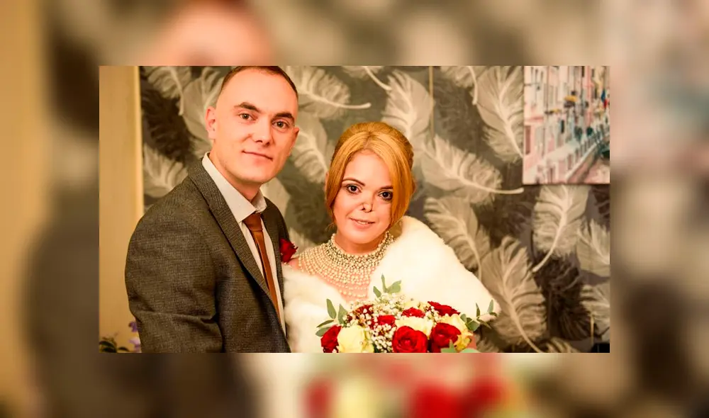 “Después de la primera operación que me dejó sin paladar, sentí que mucha gente me miraba a la cara, algunas incluso escribieron en Facebook que me veo como un monstruo”, confesó Ana. “Después de la primera operación que me dejó sin paladar, sentí que mucha gente me miraba a la cara, algunas incluso escribieron en Facebook que me veo como un monstruo”, confesó Ana.