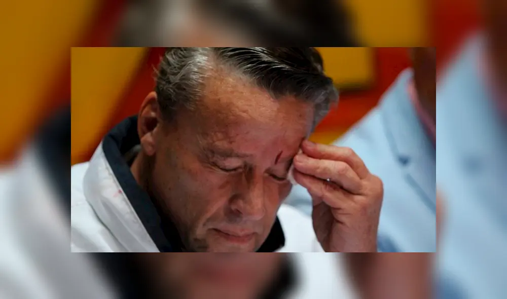 El actor fue atacado con una botella por Carlos Trejo. Foto: Difusión