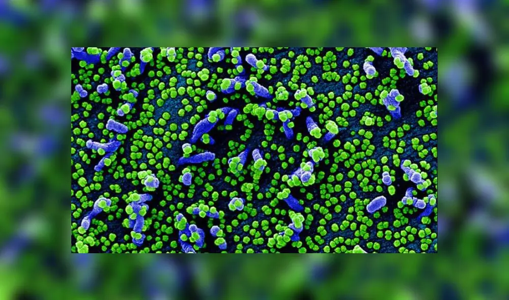 Impactantes imágenes del coronavirus atacando células humanas Impactantes imágenes del coronavirus atacando células humanas