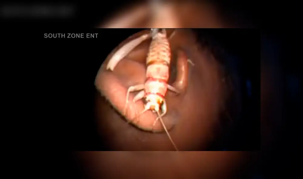 YouTube viral: médico encuentra 'misteriosa criatura' dentro de oído que genera terror [VIDEO]