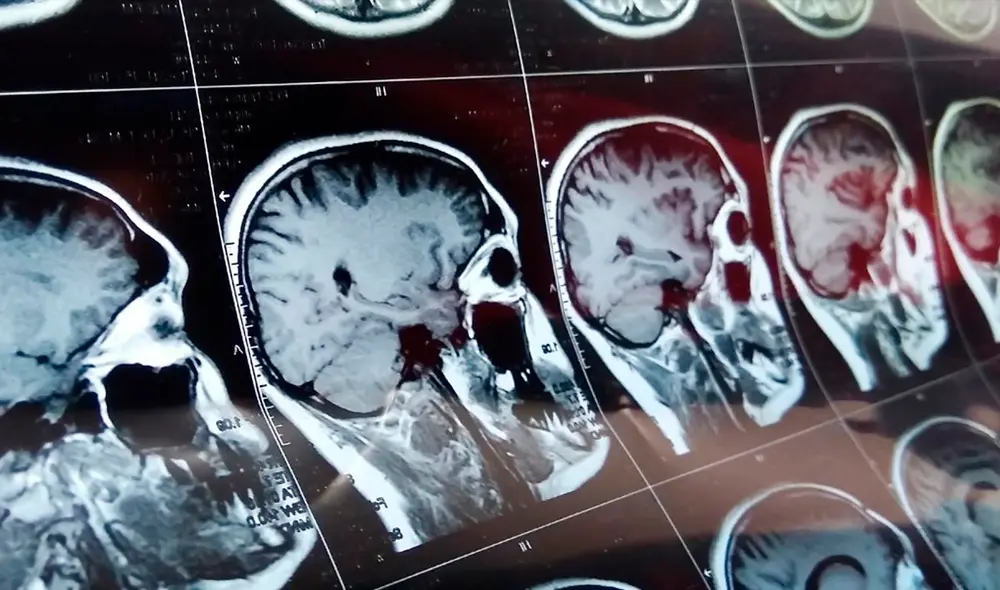 Resonancia magnética cerebral general. | Foto: Ildar Imashev Resonancia magnética cerebral general. | Foto: Ildar Imashev