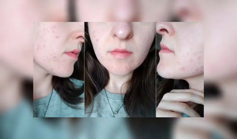 Joven sufre decepción amorosa porque pareja terminó con ella al verla sin maquillaje