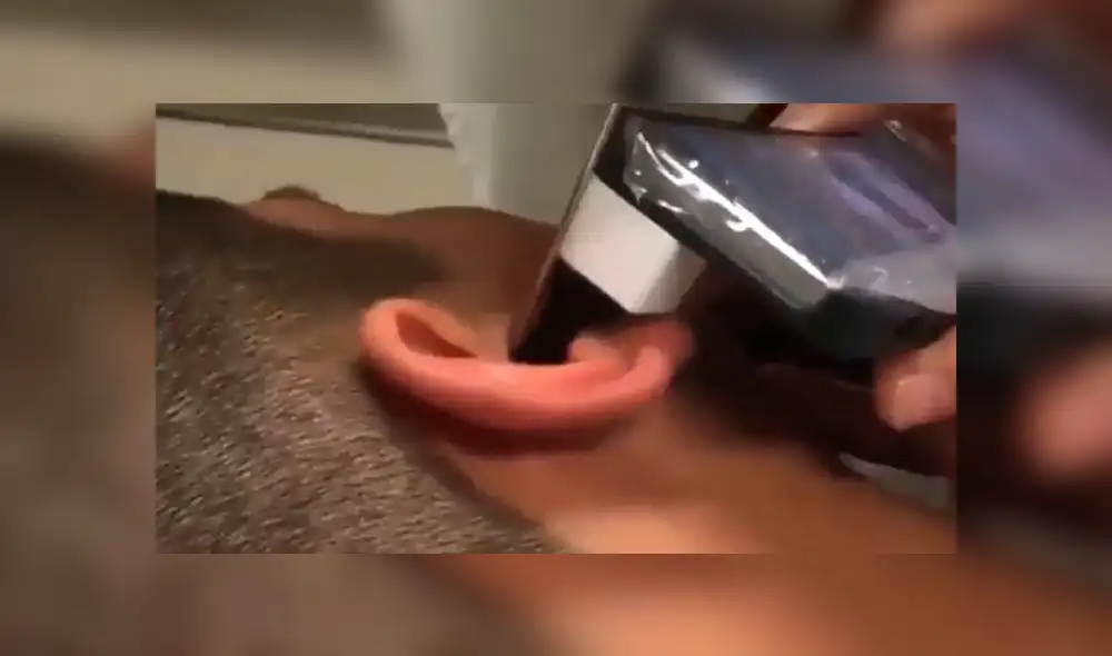 Facebook viral: nunca imaginarás la aterradora criatura que encontró este joven dentro de su oído [VIDEO] 