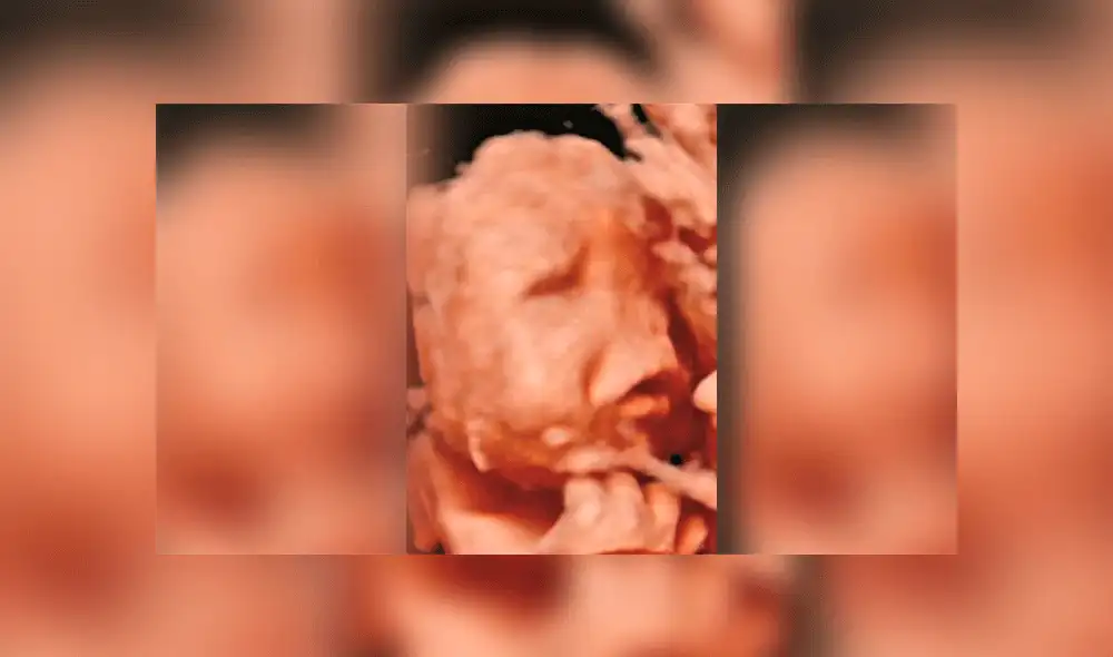 Cuando vino al mundo el pronóstico era poco alentador. Ahora está cerca de cumplir un mes, nació el pasado 7 de octubre en Portugal.